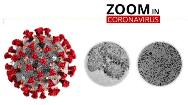 Wujud dari Dekat Virus Corona yang Renggut Ratusan Nyawa