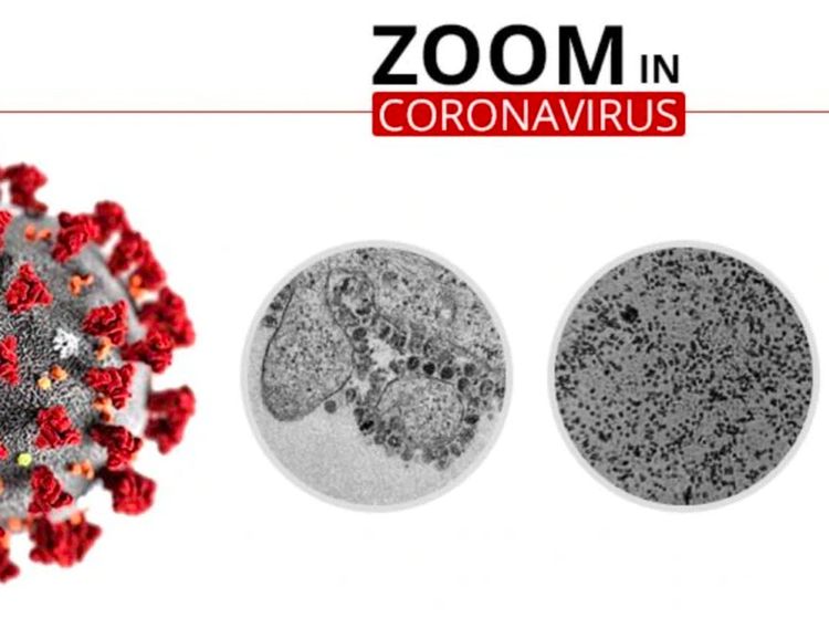 Wujud dari Dekat Virus Corona yang Renggut Ratusan Nyawa