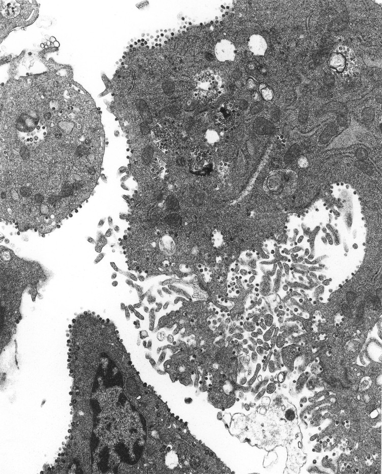 foto mikroskopik virus corona foto mikroskopik virus corona