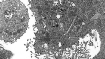 Setiap sel yang terinfeksi menghasilkan ribuan partikel virus infeksius baru yang dapat terus menginfeksi sel-sel baru, demikian pernyataan University of Hong Kong. Foto: CDC/Getty Images