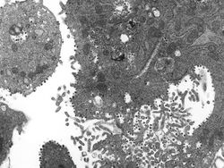 Wujud Virus Corona Dilihat dari Dekat, Mengerikan!