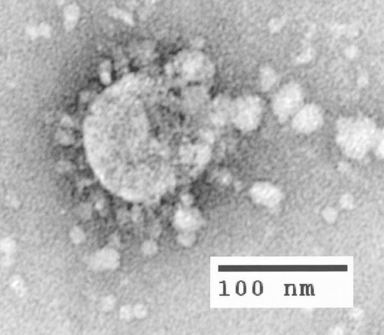 foto mikroskopik virus corona foto mikroskopik virus corona