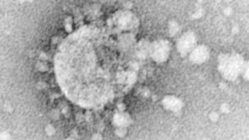 Gambar dari Centers for Disease Control and Prevention (CDC) menunjukkan bagian tipis isolat virus corona kemungkinan penyebab penyakit misterius yang dikenal sebagai sindrom pernafasan akut parah (SARS) 2 April 2003 di Atlanta, Georgia. Menurut CDC, virus yang menyebabkan SARS mungkin merupakan virus yang sebelumnya tidak dikenal dari keluarga Coronavirus. Penyakit ini diyakini berasal dari China dan telah menyebar ke seluruh dunia. Foto: CDC/Getty Images