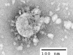 Wujud Virus Corona Dilihat dari Dekat, Mengerikan!