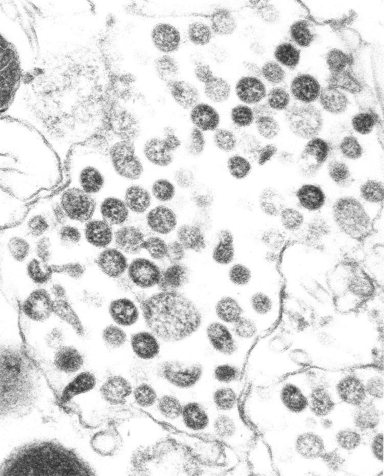 foto mikroskopik virus corona foto mikroskopik virus corona