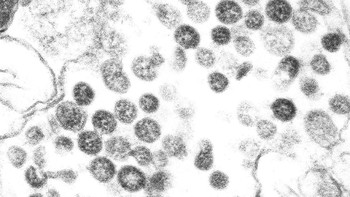 Kisaran diameter virus ini antara 20 nanometer--nanometer adalah seperseribu mikrometer--hingga 1 mikrometer. Foto: CDC/Getty Images
