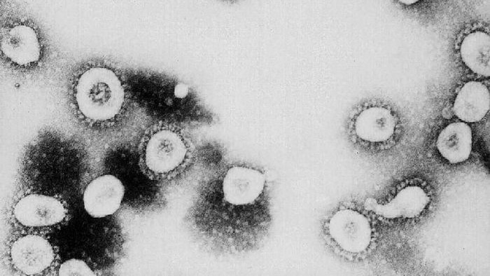 foto mikroskopik virus corona