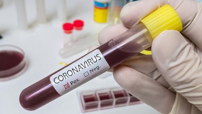 satu keluarga terserang virus corona setelah makan hot pot dan bbq bareng