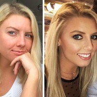 Shannon Niemberger mengatakan ketika dia memakai makeup lengkap, orang-orang bersikap sangat baik padanya. Para pria pun mendekatinya untuk berkenalan. Tapi jika tak pakai makeup, ketika alisku botak, jarang sekali ada yang memuji, tuturnya seperti dilansir Brightside. Foto: Dok. Brightside/Quora