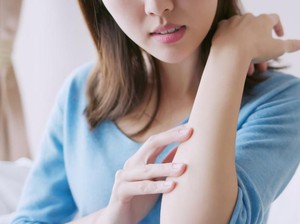 Bukan Digaruk! Ini 3 Tips Atasi Biduran bagi Ibu Menyusui