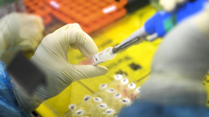 COVID-19 Resmi jadi Nama Panggilan Virus Corona WHO resmi menamai virus Corona yang menewaskan 1.115 orang. Virus mematikan yang pertama kali diidentifikasi di China pada 31 Desember itu dinamai COVID-19.