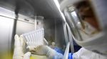 COVID-19 Resmi jadi Nama Panggilan Virus Corona