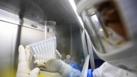 CO adalah singkatan dari corona, VI singkatan dari virus, D untuk penyakit (disease), dan 19 untuk tahun 2019, karena virus corona jenis baru ini pertama kali dikonfirmasi secara resmi pada Desember tahun lalu.