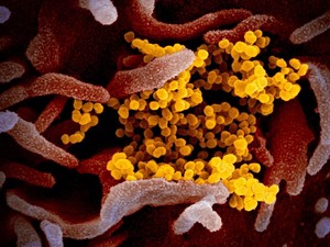 Kamu Bisa Bantu Penelitian Virus Corona, Ini Caranya!