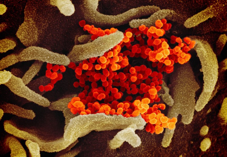 Virus Corona dilihat dari mikroskop