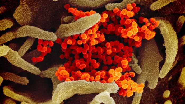 Virus Corona dilihat dari mikroskop