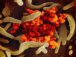 Begini Wujud Virus Corona  Dilihat dari Mikroskop