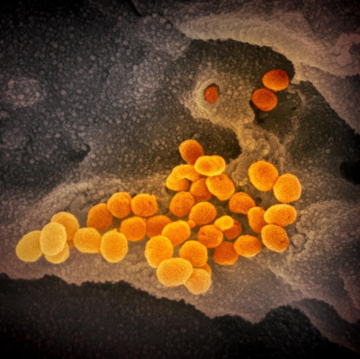 Virus Corona dilihat dari mikroskop