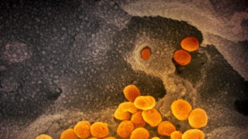 Pada hari Selasa, Organisasi Kesehatan Dunia secara resmi menyebutkan penyakit yang disebabkan oleh coronavirus baru: COVID-19. Foto: National Institute of Allergy and Infectious Diseases