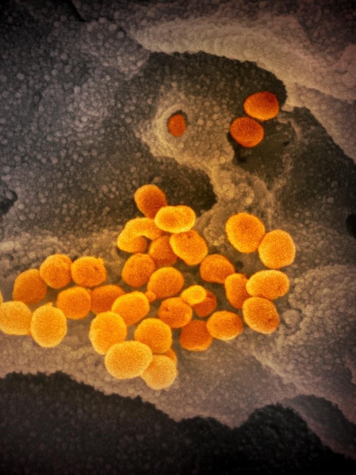 Virus Corona dilihat dari mikroskop