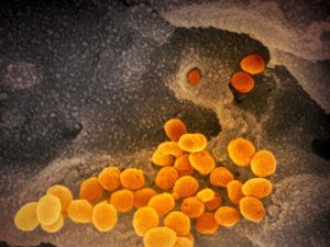 Ada virus Corona Jangan Panik, Begini Cara Mencegahnya