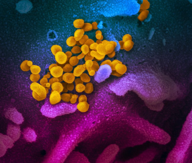 Virus Corona dilihat dari mikroskop Virus Corona dilihat dari mikroskop