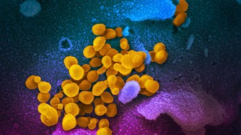 Tampilan virus corona di bawah mikroskop. Foto: National Institute of Allergy and Infectious Diseases