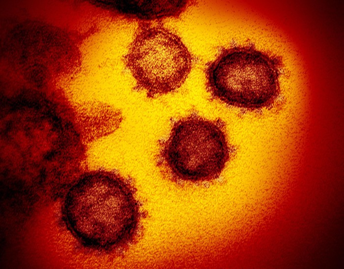 Virus Corona dilihat dari mikroskop