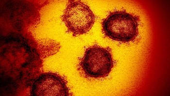 Sejauh ini ada lebih dari 47.000 kasus yang dikonfirmasi laboratorium dan lebih dari 1.300 kematian. Foto: National Institute of Allergy and Infectious Diseases