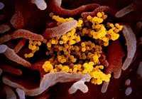 Virus Corona dilihat dari mikroskop