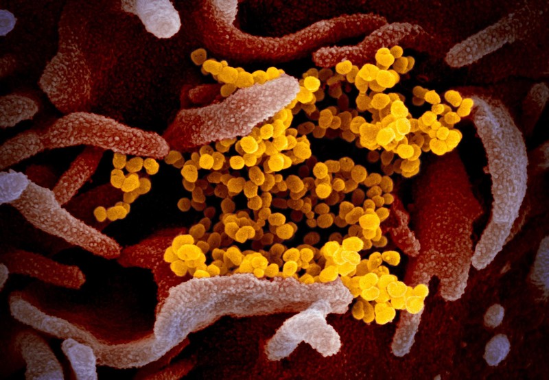 Virus Corona dilihat dari mikroskop