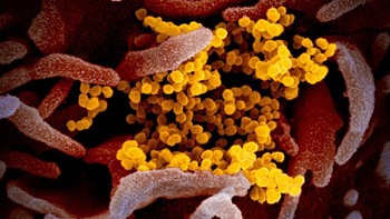 Gambar-gambar ini dibuat menggunakan pemindaian dan transmisi elektron mikroskop. Foto: National Institute of Allergy and Infectious Diseases