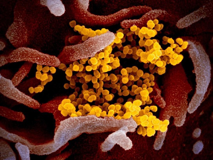 Virus Corona dilihat dari mikroskop