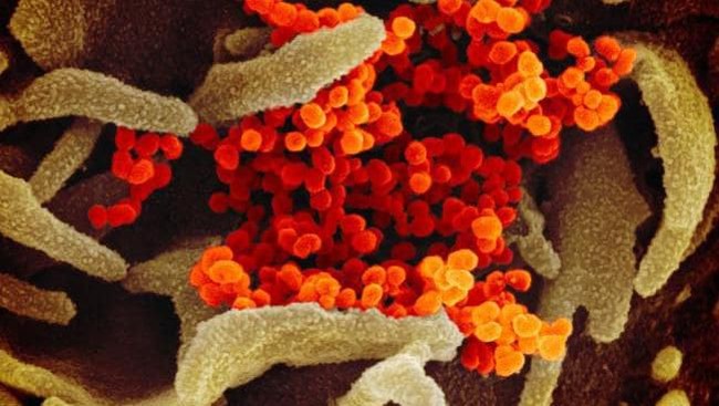 virus corona COVID-19 menginvasi sel-sel tubuh pasien virus corona COVID-19 menginvasi sel-sel tubuh pasien
