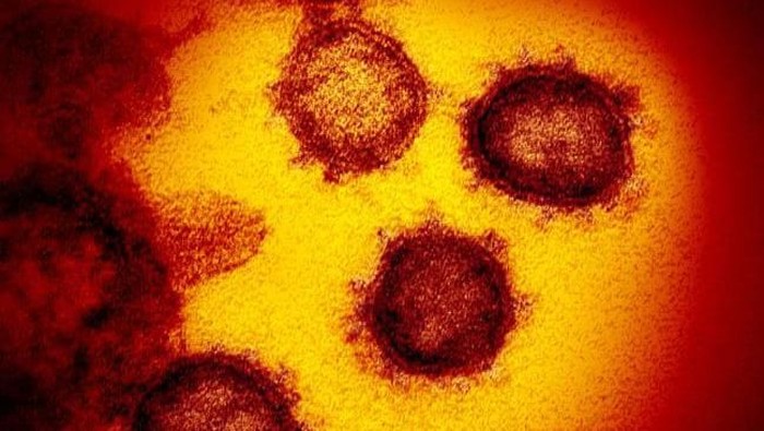 virus corona COVID-19 menginvasi sel-sel tubuh pasien virus corona COVID-19 menginvasi sel-sel tubuh pasien
