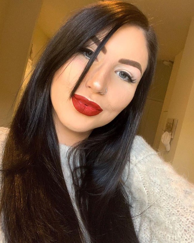 Hidupku penuh dengan perjuangan yang berat sejak kecelaan tersebut. Aku telah berjuang selama bertahun-tahun dari depresi dan masalah kecemasan, ungkapnya. Foto: dok. Instagram