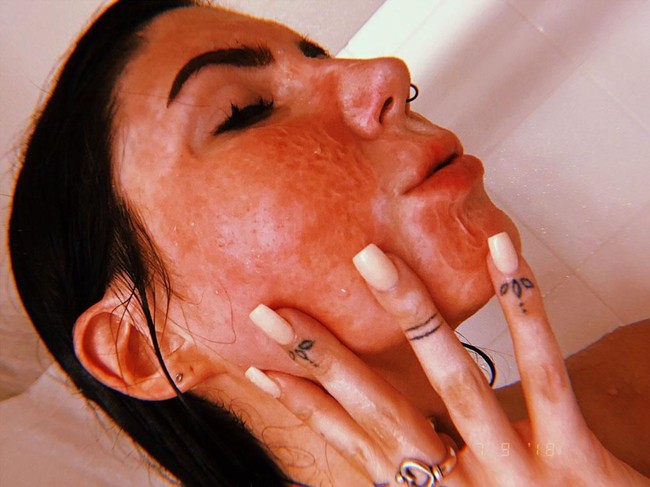 Tapi belakangan, Delaney mencoba menerima keadaannya. Dia berbagi cerita-cerita inspiratif di Instagramnya hingga memiliki followers lebih dari 10 ribu. Di usia 16 tahun saat itu karena kecelakaan membuatku dewasa sangat pesat dan tidak memiliki kepercayaan diri sampai belakangan aku menjadi menerima lukaku dan lebih sering tampil tanpa makeup, ujar Delaney, seperti dikutip Daily Star. Foto: Instagram