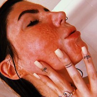 Tapi belakangan, Delaney mencoba menerima keadaannya. Dia berbagi cerita-cerita inspiratif di Instagramnya hingga memiliki followers lebih dari 10 ribu. Di usia 16 tahun saat itu karena kecelakaan membuatku dewasa sangat pesat dan tidak memiliki kepercayaan diri sampai belakangan aku menjadi menerima lukaku dan lebih sering tampil tanpa makeup, ujar Delaney, seperti dikutip Daily Star. Foto: Instagram