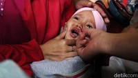 Seorang balita tengah diberi vitamin A.