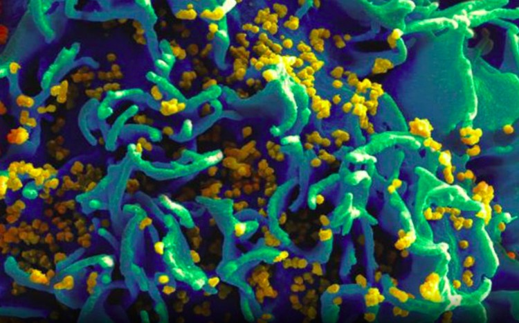 virus dan bakteri virus dan bakteri