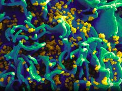 Foto Mikroskopis Bermacam Virus dan Bakteri