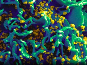 10 Virus dan Bakteri yang Dipakai Senjata Biologis Mematikan