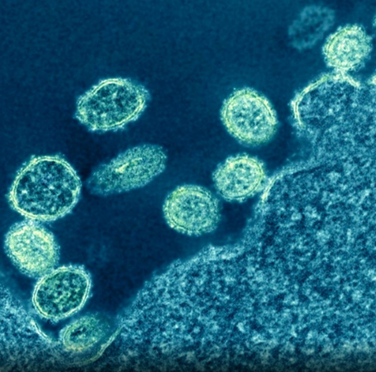 virus dan bakteri virus dan bakteri
