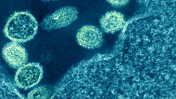 Mikrograf dari partikel virus influenza 1918 H1N1 yang berada di dekat sel. Foto: NIAID via Weather.com