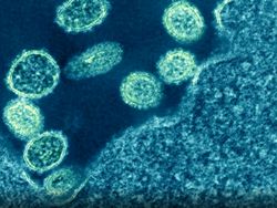 Foto Mikroskopis Bermacam Virus dan Bakteri