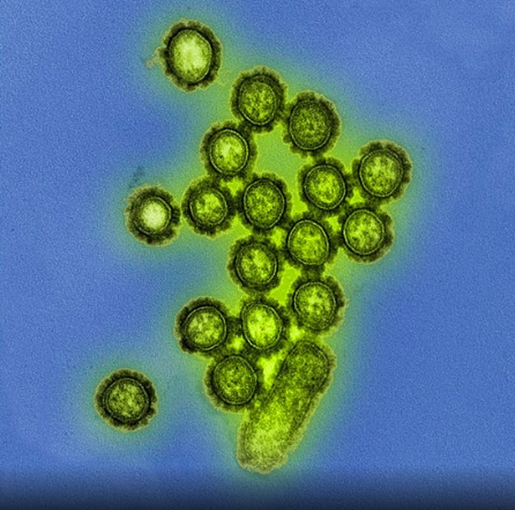 virus dan bakteri virus dan bakteri