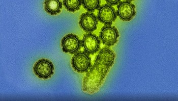 Mikrograf berwarna menunjukkan partikel virus influenza H1N1 atau Flu Babi. Permukaan protein pada partikel virus ditampilkan dalam warna hitam. Foto: NIAID via Weather.com