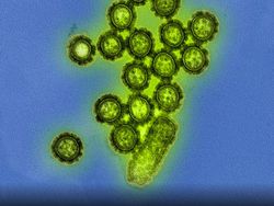 Foto Mikroskopis Bermacam Virus dan Bakteri