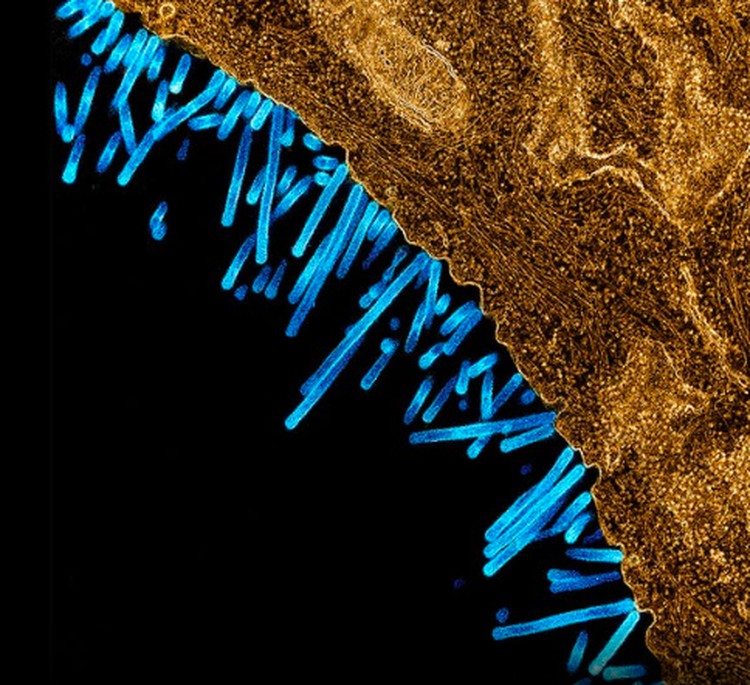 virus dan bakteri virus dan bakteri