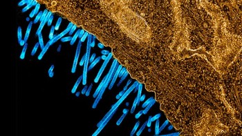 Mikrograf berwarna dari partikel virus influenza SW31 (biru) yang melekat dan bertunas dari permukaan sel MDCK (oranye). Gambar diambil dan ditingkatkan warnanya di NIAID Integrated Research Facility in Fort Detrick, Maryland, AS. Foto: NIAID via Weather.com